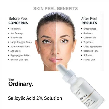 The Ordinary - Niacinamide 10% + Zinc 1% Serum 30ml